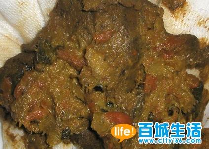 详细解释宝宝的大便情况!慎入哈.