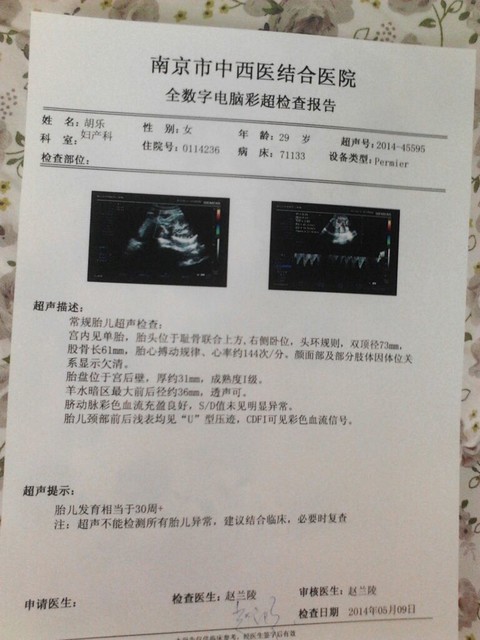 b超医生暗示语_b超医生收入(3)