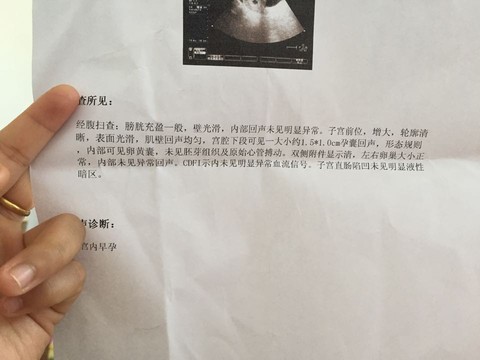 有没有孕囊在宫腔下段的