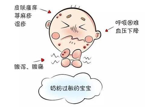 科学在于,对牛奶蛋白小敏感,不等于宝宝不能吃配方奶