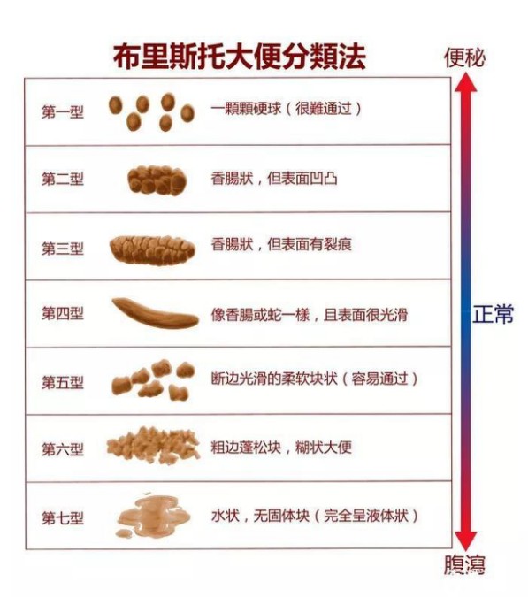 记住这些颜色和性状,一次读懂宝宝便便里的秘密