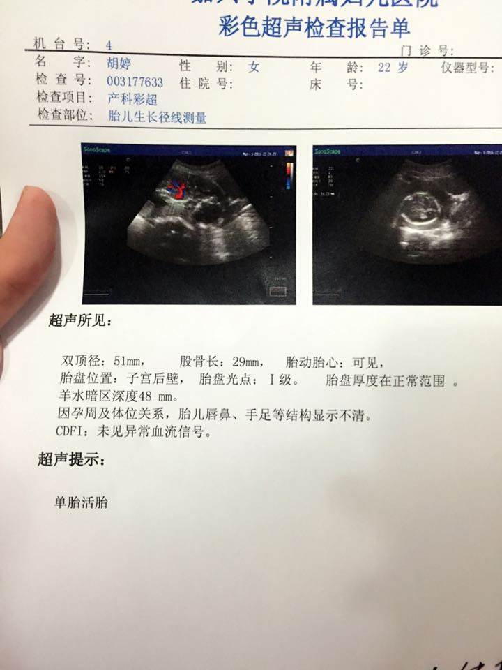 怀孕五个月了被查出得了淋病。