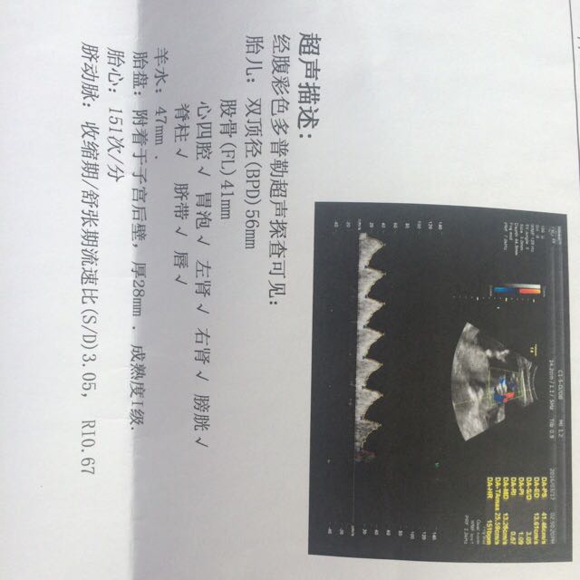 😌😌B超图片怎么看男孩女孩