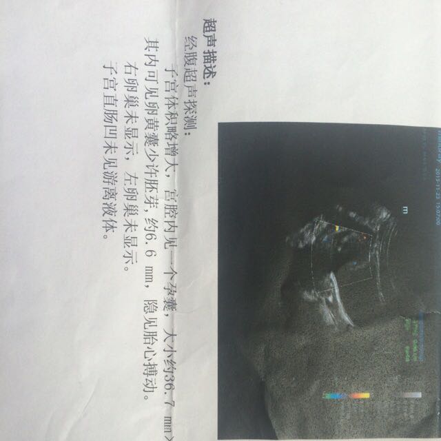 😌😌B超图片怎么看男孩女孩