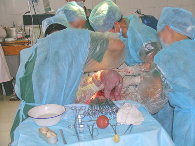 宝爸宝妈必看:宝宝出生全过程(我老公强烈推荐!