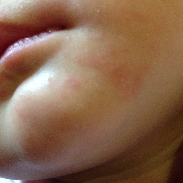 宝贝下巴这是长的什麼呀.