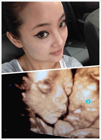 怀孕32周四维胎儿图片图片