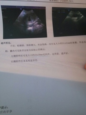 journal_insert_pic_121771545