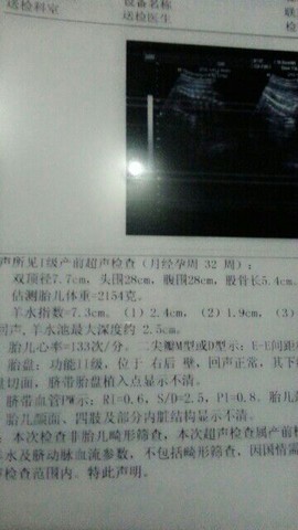 journal_insert_pic_122406414