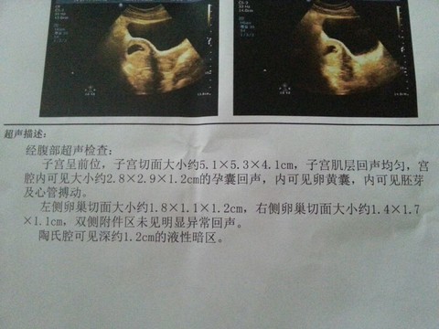 journal_insert_pic_122785492