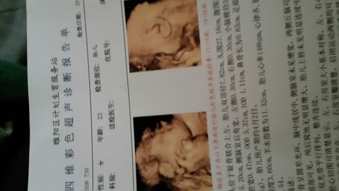 journal_insert_pic_123414014