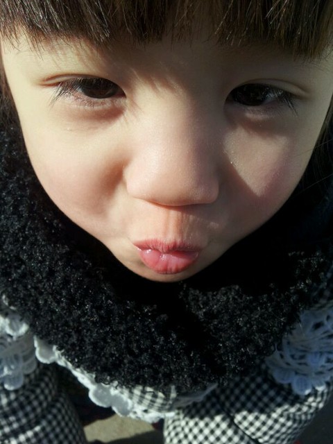 一生下来就是双眼皮,医生都说不可能.希望二_宝宝树