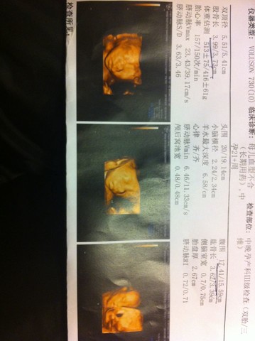 journal_insert_pic_124240787