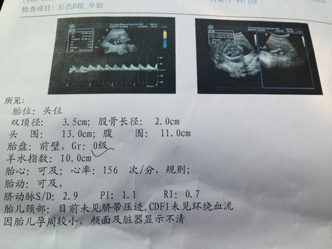 journal_insert_pic_126408841
