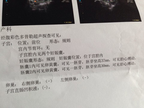 journal_insert_pic_126884479