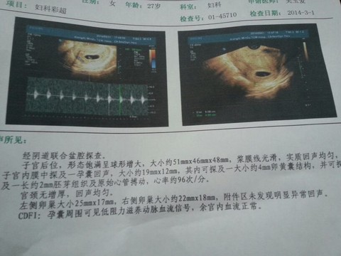 journal_insert_pic_127345829