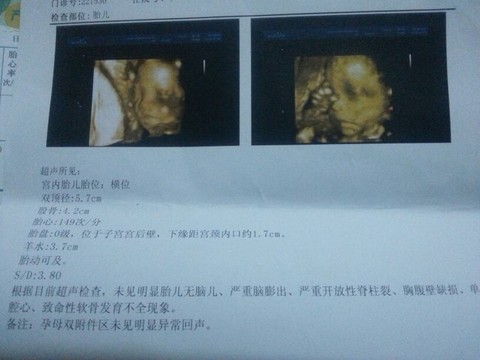 journal_insert_pic_127605281