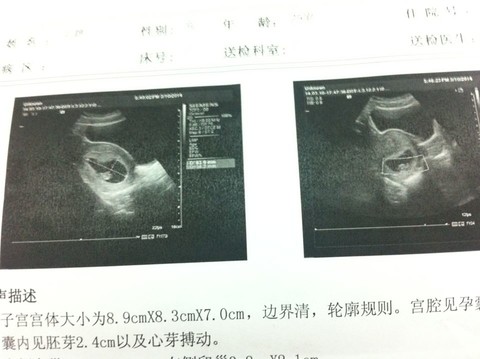 journal_insert_pic_128455653
