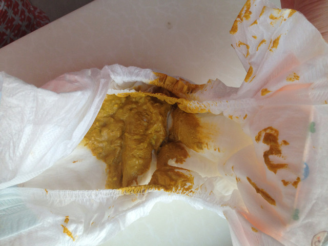 纪录宝宝大便情况