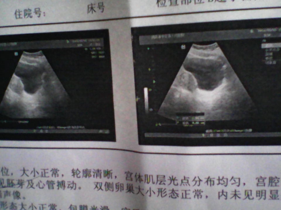 journal_insert_pic_129052972