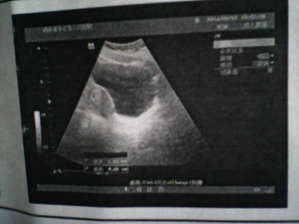 journal_insert_pic_129052960