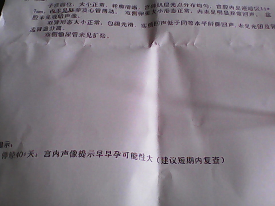 journal_insert_pic_129051694
