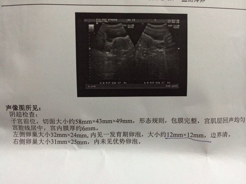 journal_insert_pic_129548499