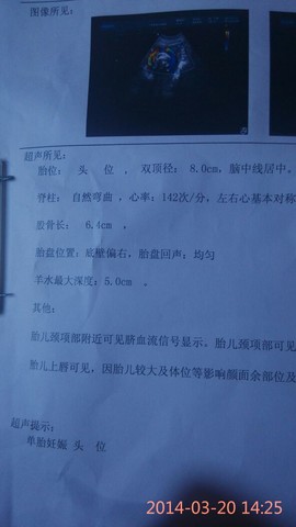 journal_insert_pic_129648294