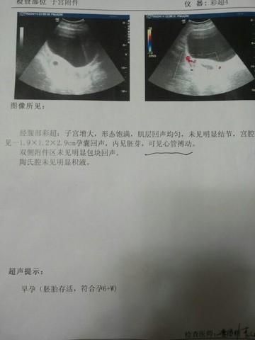 journal_insert_pic_130175370