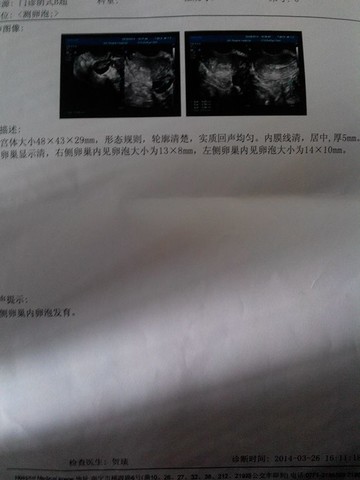 journal_insert_pic_130710807