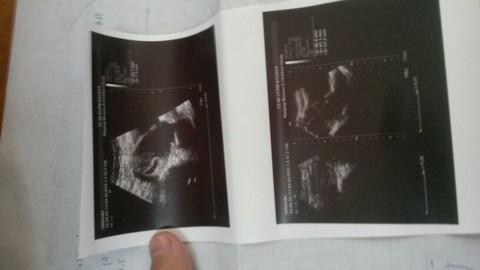 journal_insert_pic_131299528