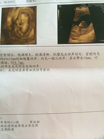 journal_insert_pic_131897360