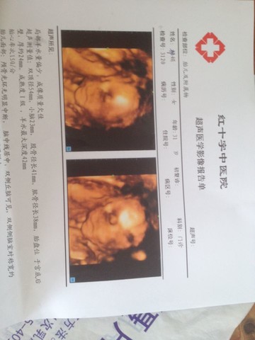 journal_insert_pic_132061756