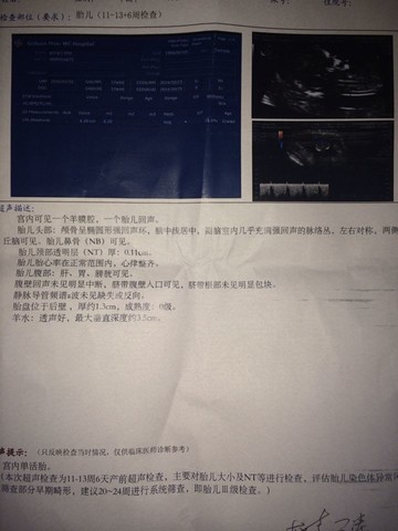 journal_insert_pic_133173515