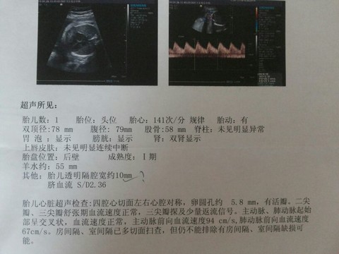 journal_insert_pic_134792981