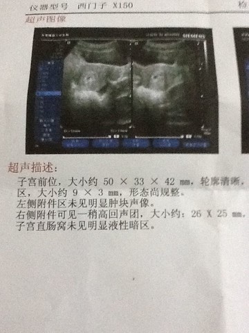journal_insert_pic_135503152