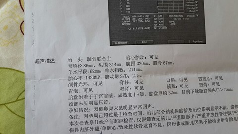 journal_insert_pic_138119169