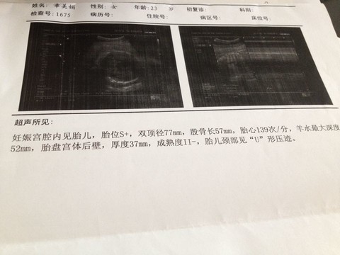 journal_insert_pic_138370280