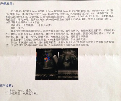 journal_insert_pic_138905158