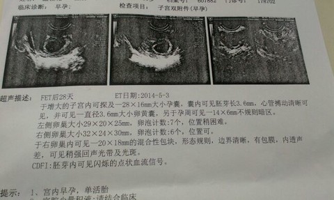 journal_insert_pic_139150559