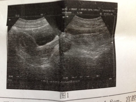 journal_insert_pic_139429906
