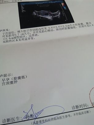journal_insert_pic_140845277