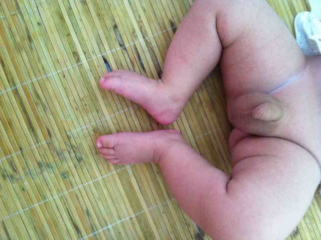 15个月宝宝腿弯的图片图片