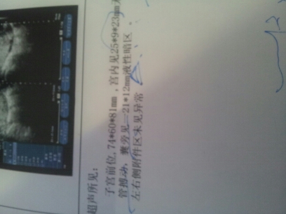 journal_insert_pic_141507098