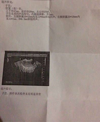 journal_insert_pic_142019270