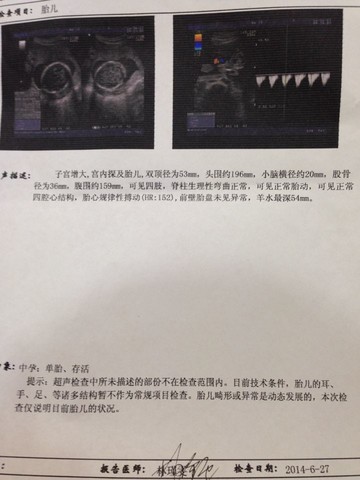 journal_insert_pic_142398258