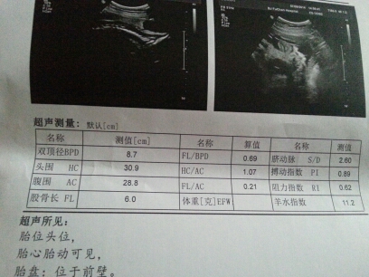 journal_insert_pic_143867899