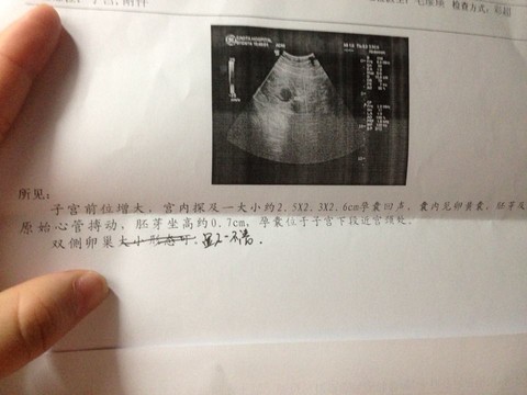 journal_insert_pic_146147237
