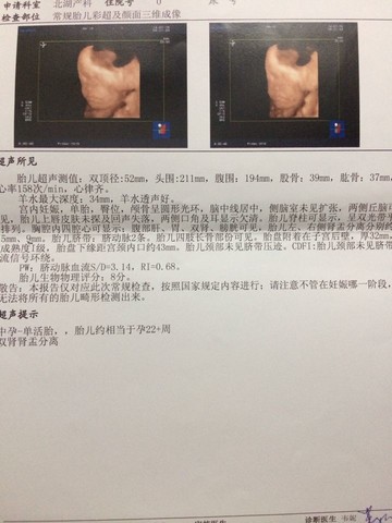 journal_insert_pic_146563906