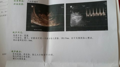 journal_insert_pic_146918576